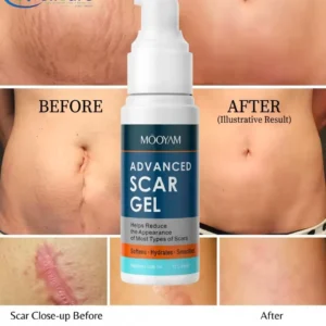 Mooyam Advance Scar Gel