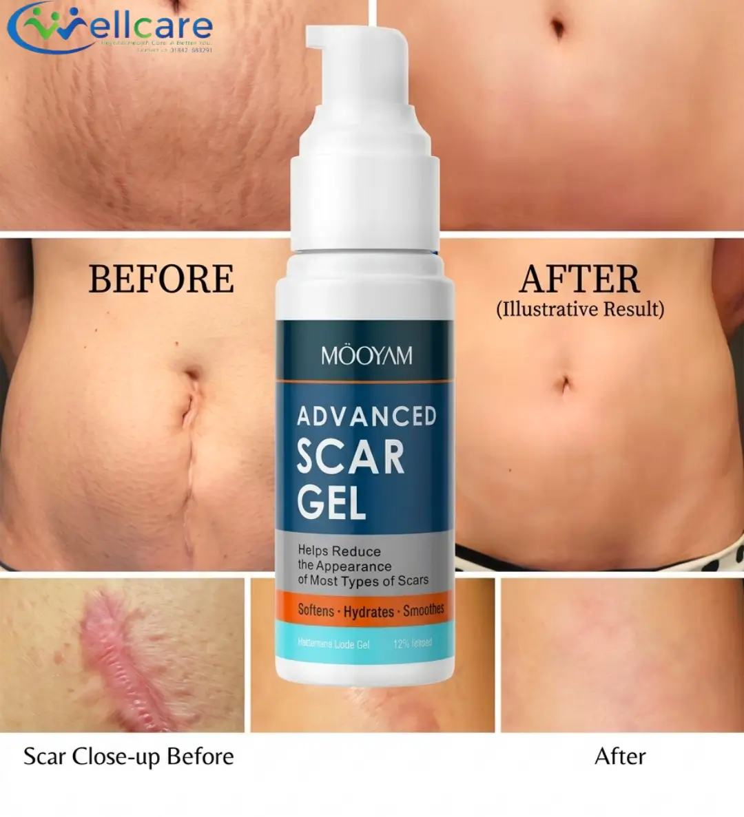 Mooyam Advance Scar Gel